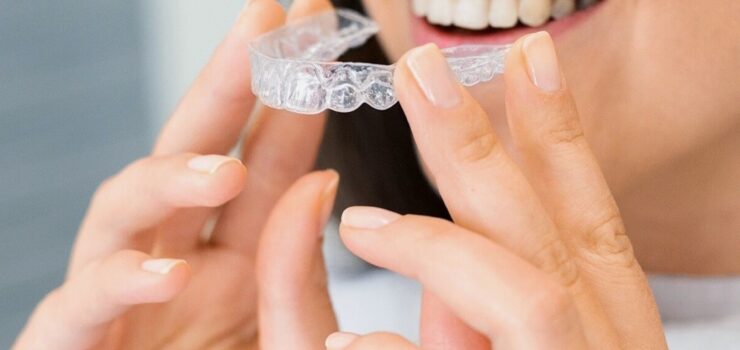 invisalign barcelona